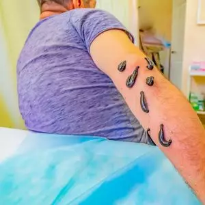 Гирудотерапия в санатории Центросоюз в городе Кисловодске - фотография